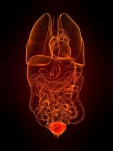 tumore vescica, Il Tumore della Vescica: Fatti e Misfatti