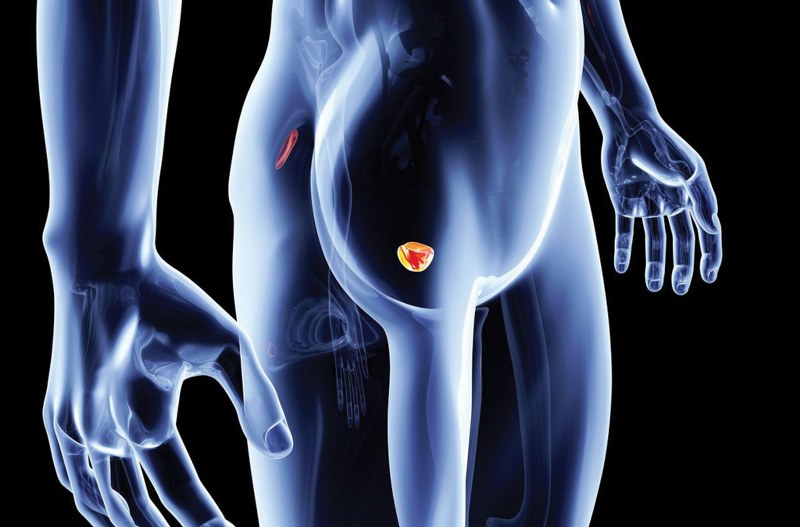 La diagnosi del tumore della prostata di ultima generazione: la biopsia in fusione di immagini