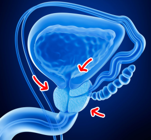 biopsia prostata roma