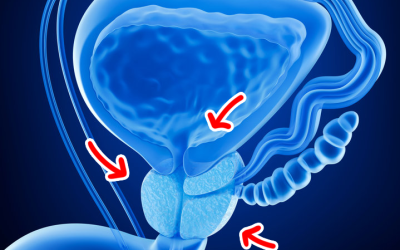 Biopsia prostata fusion: il tumore della prostata nel mirino della tecnologia