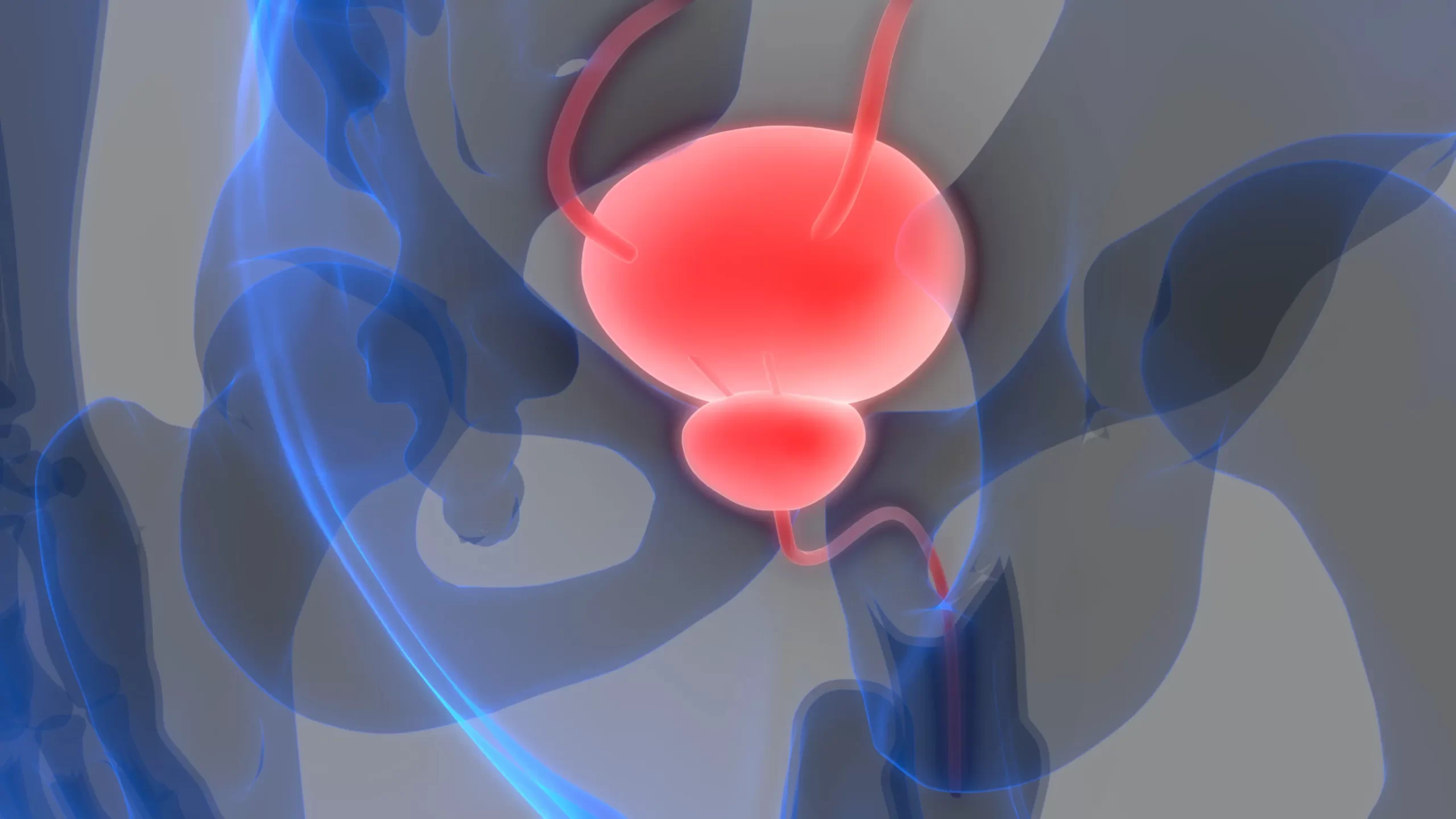 Tumore della vescica, Tumore Vescicale – Concetti generali